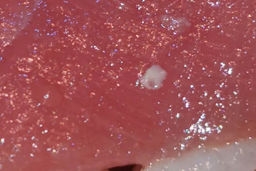 raw fish parasites